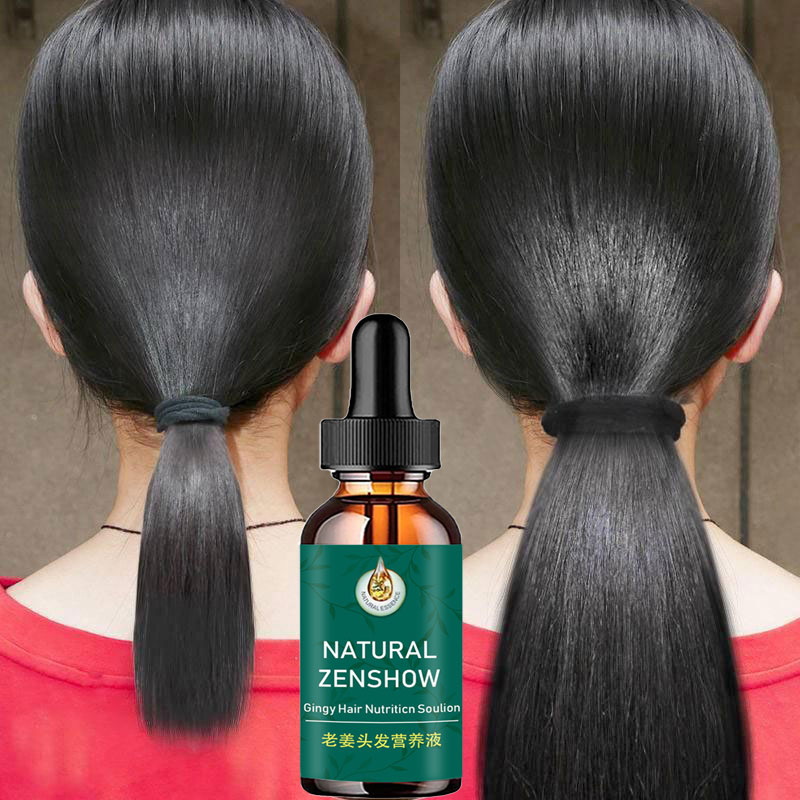 Hair Care Herbal Products - Minyak esensial penumbuh rambut jahe, produk
