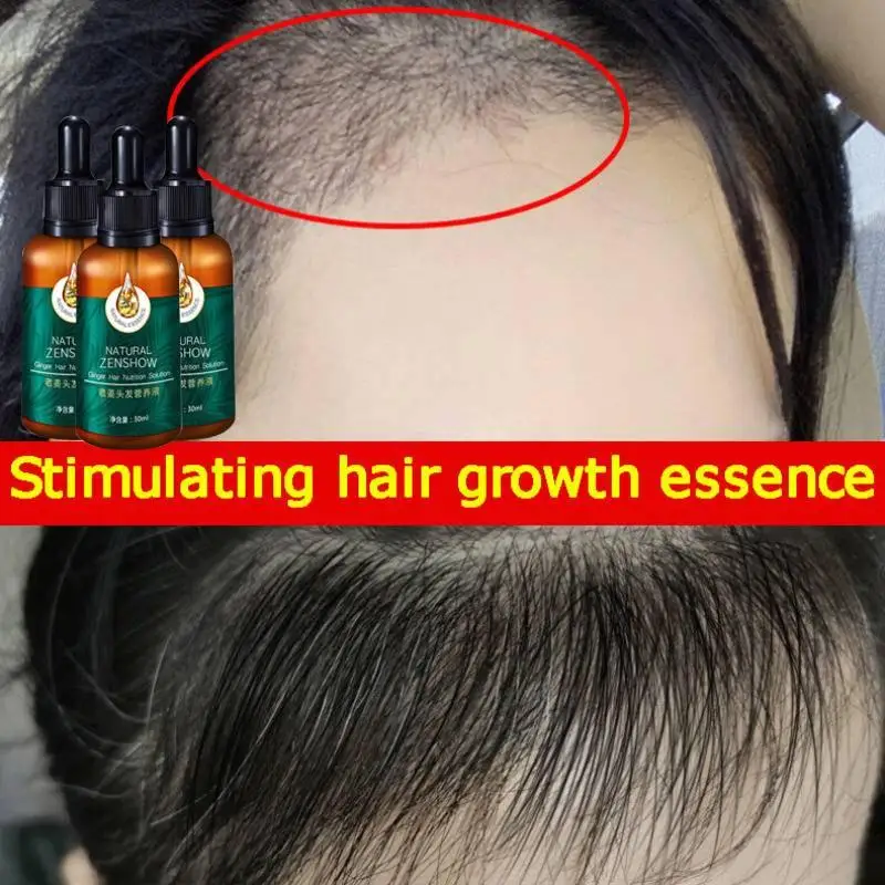 Minyak esensial penumbuh rambu - Hair Care Herbal Products ulasan dan harga