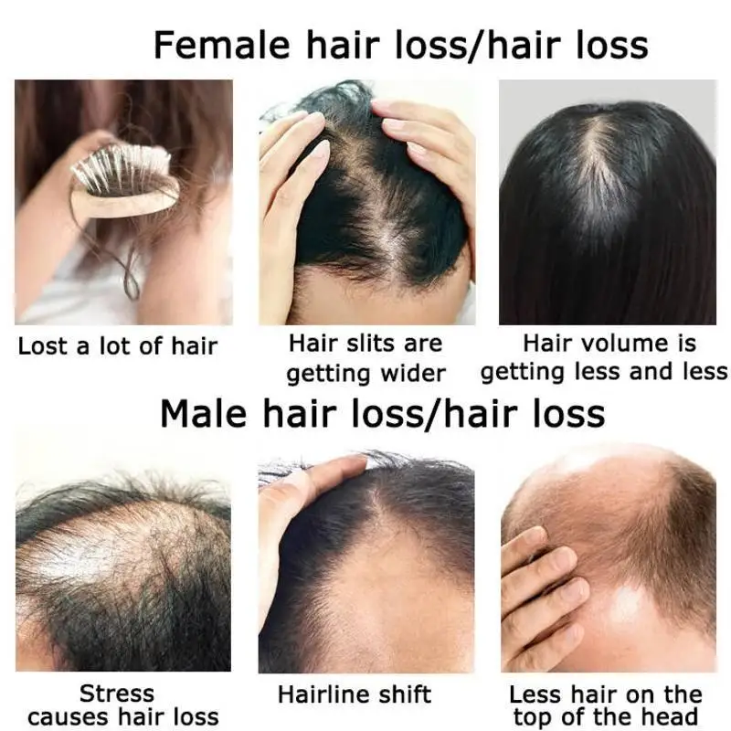 Minyak esensial penumbuh rambu - Hair Care Herbal Products ulasan dan harga