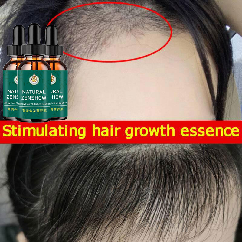 Minyak esensial penumbuh rambu - Hair Care Herbal Products ulasan dan harga