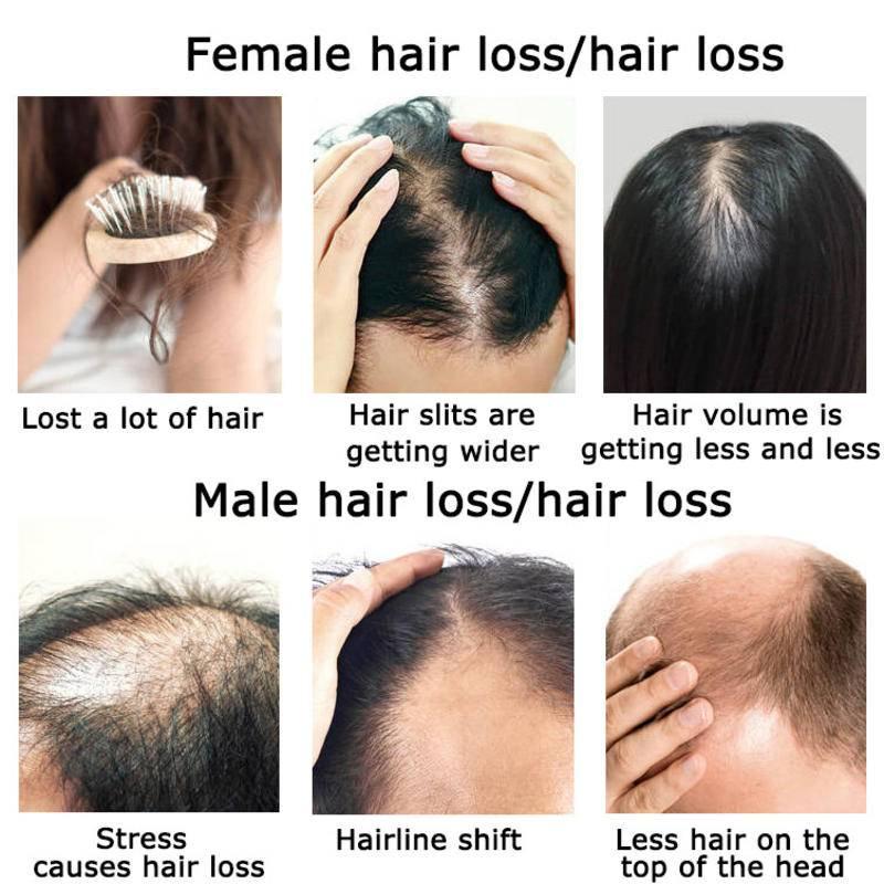 Minyak esensial penumbuh rambu - Hair Care Herbal Products ulasan dan harga