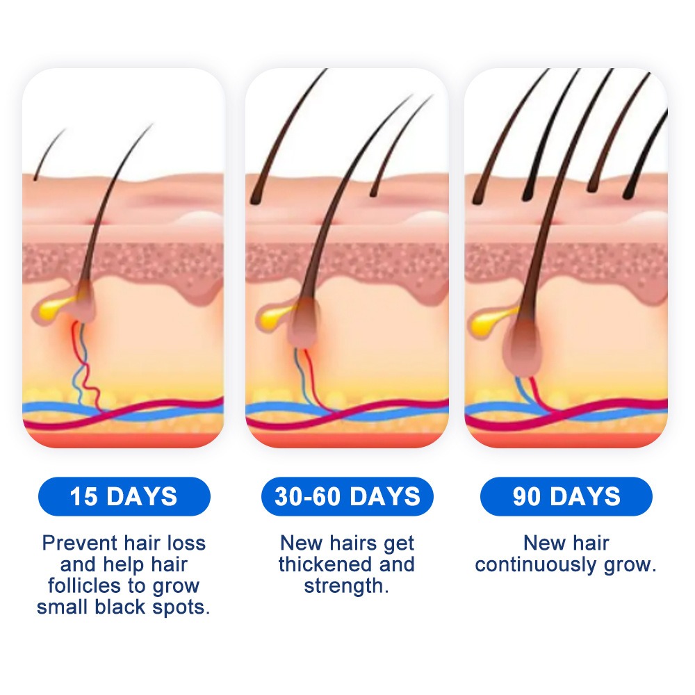 Semprotan Penumbuh Rambut Alop - Hair Care Spray ulasan dan harga