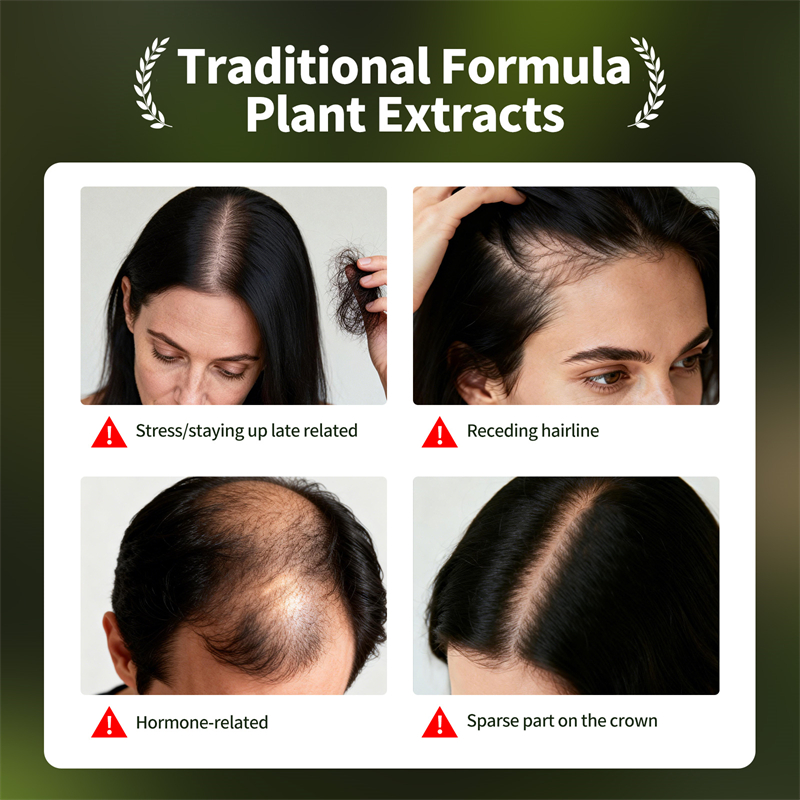 Set Perawatan Rambut Alami Usm - Hair Care Herbal Products ulasan dan harga