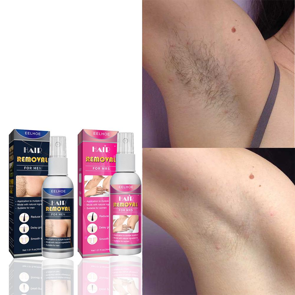 1/2 Buah Penghilang Rambut Per - Hair Care Spray ulasan dan harga