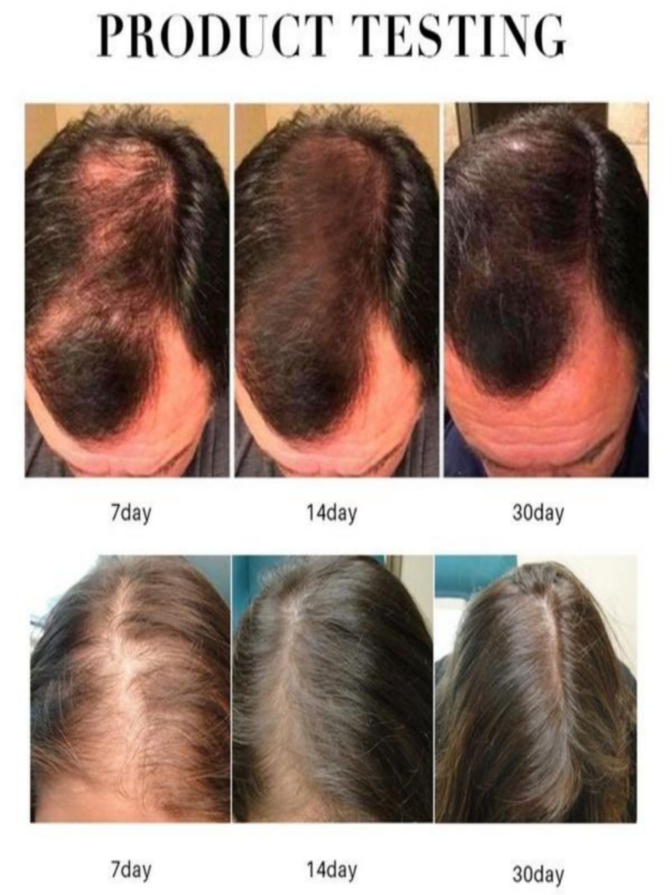 Semprotan Minyak Esensi Pertum - Hair Care Herbal Products ulasan dan harga