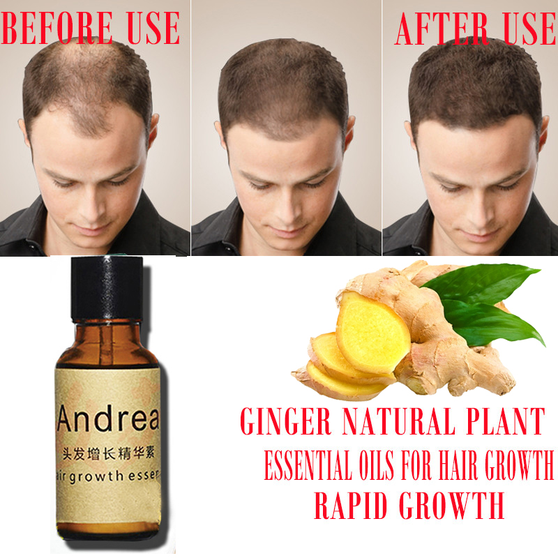 Andrea Serum penumbuh rambut H - Hair Care Herbal Products ulasan dan harga
