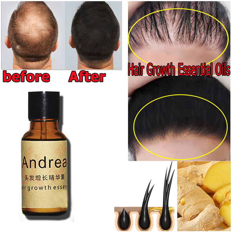 Andrea Serum penumbuh rambut H - Hair Care Herbal Products ulasan dan harga
